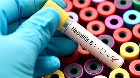Hipertansiyon hepatite bağlı olabilir mi?